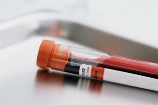 Nylig ble det innledet en blodprøve for å forutsi økt selvmordsrisiko, men kan vi virkelig forutsi selvmordsrisiko med en enkel blodprøve?
